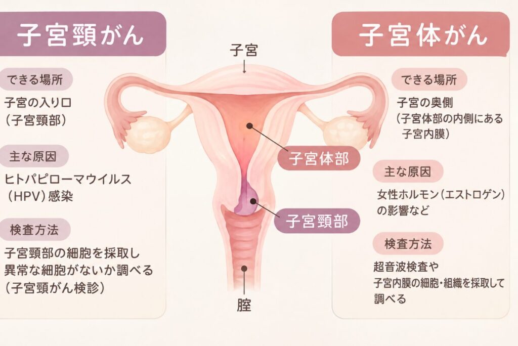 子宮頸がんと子宮体がんの発生部位の違い