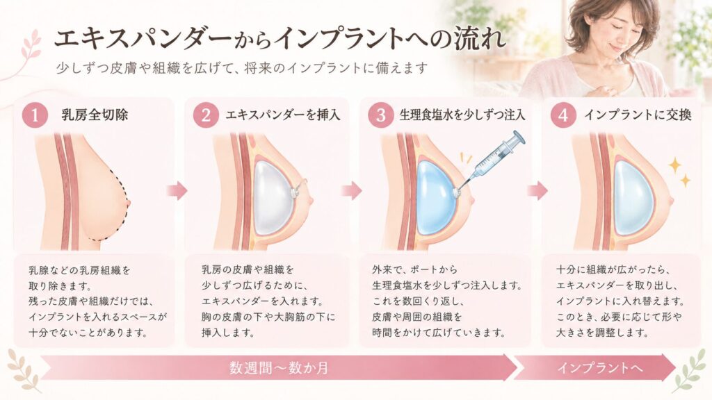 乳房再建でエキスパンダーからインプラントへ交換する流れ